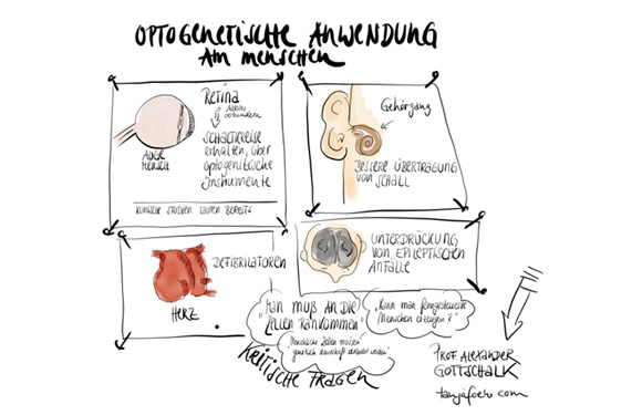 Handgezeichnete Sketchnotes zum Thema Optogenetische Anwendungen am Menschen